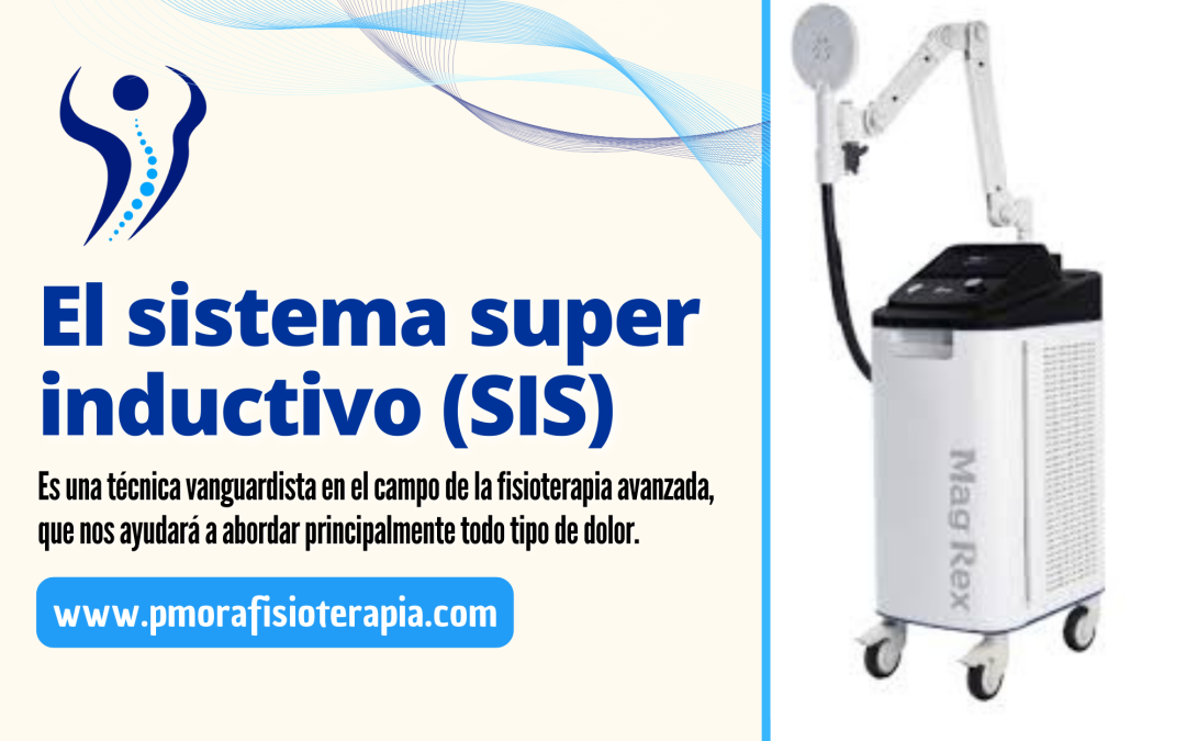 El sistema super inductivo (SIS)