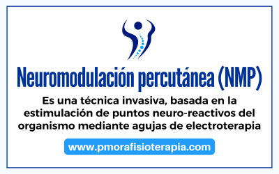 Neuromodulación percutánea (NMP)