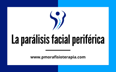 La parálisis facial periférica